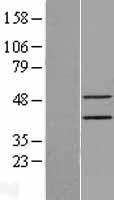 ls094240 epithelial stromal interaction 1 epsti1 human over expression lysates nm 001002264 wb testing 1