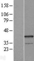 ls094240 epithelial stromal interaction 1 epsti1 human over expression lysates nm 033255 wb testing 2