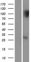 ls094241 p53 dinp1 tp53inp1 human over expression lysates nm 033285 wb testing 1