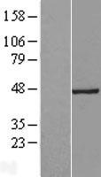 ls095681 tsga14 cep41 human over expression lysates nm 018718 wb testing 1