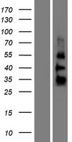 ZGLP1 Human Over-expression Lysates NM_001103167
