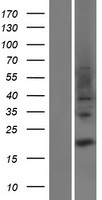 TRAPPC3L Human Over-expression Lysates NM_001139444