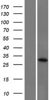 CCDC152 Human Over-expression Lysates NM_001134848