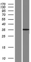 SYCE1L Human Over-expression Lysates NM_001129979