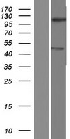NEMP2 Human Over-expression Lysates NM_001142645