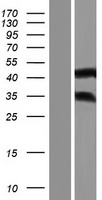 ANKRD63 Human Over-expression Lysates NM_001190479