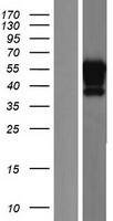Transcription Factor SP9 (SP9) Human Over-expression Lysates NM_001145250