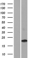 CD300LD Human Over-expression Lysates NM_001115152