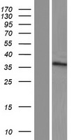 ZNF705G Human Over-expression Lysates NM_001164457