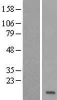 TEKT4P2 Human Over-expression Lysates NM_001033515
