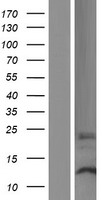 DPH3P1 Human Over-expression Lysates NM_080750