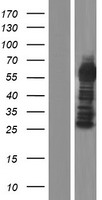 CXorf49B Human Over-expression Lysates NM_001145139