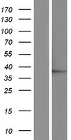 JMJD7 Human Over-expression Lysates NM_001114632