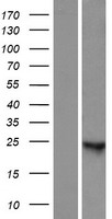 ANKRD66 Human Over-expression Lysates NM_001162435