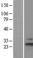 TIMM23 Human Over-expression Lysates NM_006327