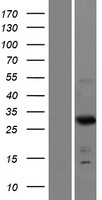 ls100288801 frg2c human over expression lysates nm 001124759 wb testing 1