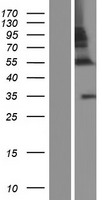 ZNF783 Human Over-expression Lysates NM_001195220