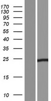 TICAM2 (TMED7-TICAM2) Human Over-expression Lysates NM_001164469