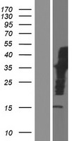 SCHIP1 (IQCJ-SCHIP1) Human Over-expression Lysates NM_001197114