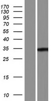 LRRC72 Human Over-expression Lysates NM_001195280