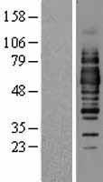 Occludin (OCLN) Human Over-expression Lysates NM_002538