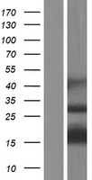 CENPS-CORT Human Over-expression Lysates NM_199006