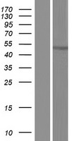 Sohlh2 (CCDC169-SOHLH2) Human Over-expression Lysates NM_001198910