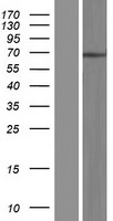 NT5C1B (NT5C1B-RDH14) Human Over-expression Lysates NM_001199104