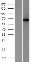 ls102724631 poteb3 human over expression lysates nm 207355 wb testing 1