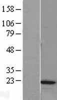 MYL12B Human Over-expression Lysates NM_001144945