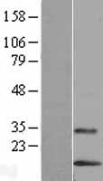 LYNX1 Human Over-expression Lysates NM_023946