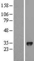 PHD3 (EGLN3) Human Over-expression Lysates NM_022073