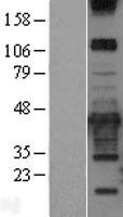 CAVIN3 Human Over-expression Lysates NM_145040