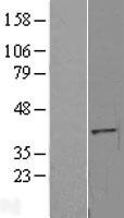 ls112479 eri2 human over expression lysates nm 080663 wb testing 1