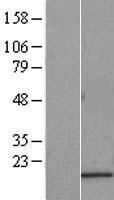 SAT2 Human Over-expression Lysates NM_133491
