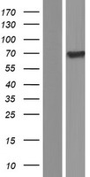 SNX18 Human Over-expression Lysates NM_001102575