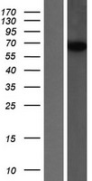 SNX18 Human Over-expression Lysates NM_052870
