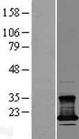 CMTM7 Human Over-expression Lysates NM_138410