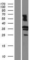 RDH13 Human Over-expression Lysates NM_001145971