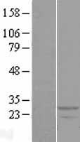 RDH13 Human Over-expression Lysates NM_138412