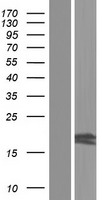 HOGA1 Human Over-expression Lysates NM_001134670