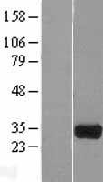 HOGA1 Human Over-expression Lysates NM_138413