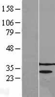 PRPK (TP53RK) Human Over-expression Lysates NM_033550