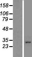 SGF29 Human Over-expression Lysates NM_138414