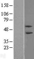 ls112885 phf21b human over expression lysates nm 138415 wb testing 1