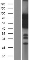 Nac1 (NACC1) Human Over-expression Lysates NM_052876