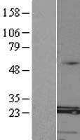 MED8 Human Over-expression Lysates NM_001001654
