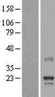 MED8 Human Over-expression Lysates NM_052877