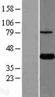 ls112970 kti12 human over expression lysates nm 138417 wb testing 1