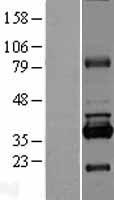 ls113000 rpusd1 human over expression lysates nm 058192 wb testing 1